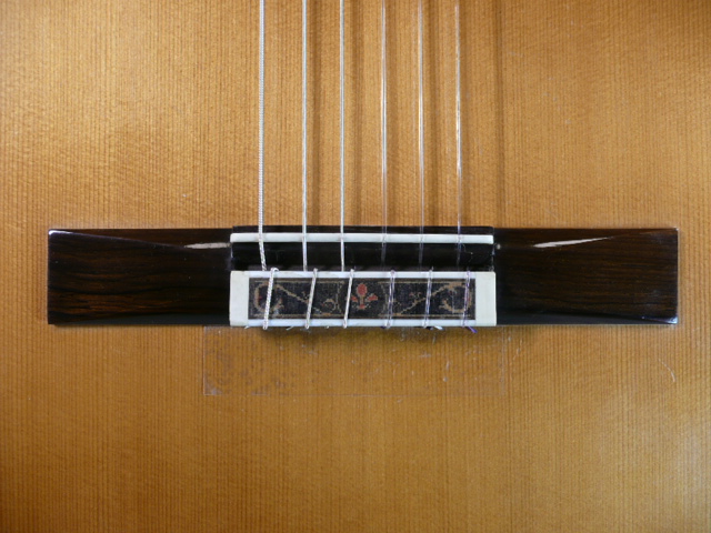 FischerConserv199?BridgeP1140469